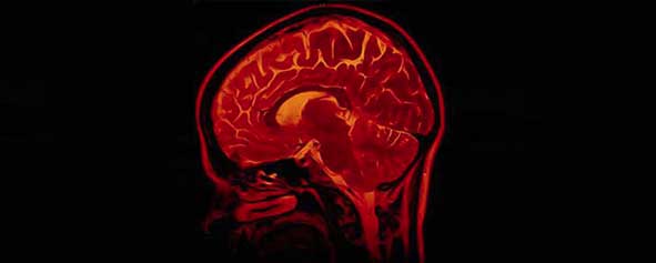 Scan of a human brain.