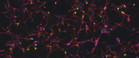 Human embryonic stem cell derived motor neuron