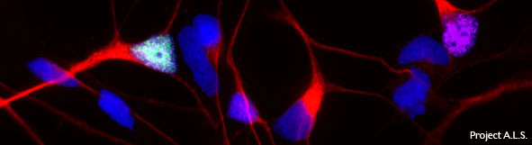 Stem-cell-derived motor neuron