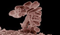 e coli