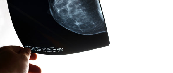 Hand holding mammogram xray