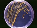 petri dish