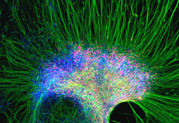 A cluster of neural cells were derived from human embryonic stem cells