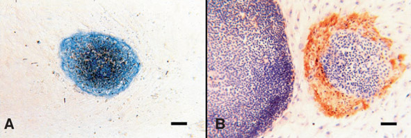 images of stem cells from Thomson's groundbreaking 1998 paper
