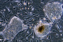 A colony of undifferentiated human embryonic stem cells.