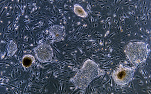 A colony of undifferentiated human embryonic stem cells.