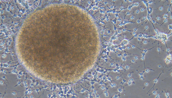 This microscopic image shows a large sphere of neural stem cells in culture, surrounded by stem cells that are leaving home, migrating away from the sphere.