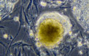 A colony of undifferentiated embryonic stem cells.