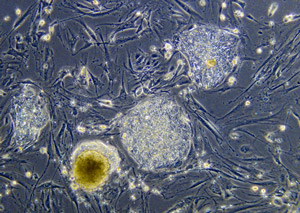 A colony of undifferentiated embryonic stem cells.