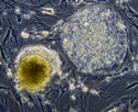 undifferentiated human embryonic stem cells