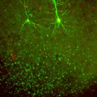 neural cells