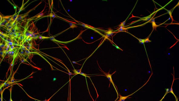 human embryonic stem cells. Human neural stem cells