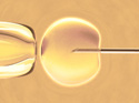in vitro fertilization under the microscope