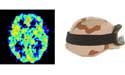 an MRI scan of a brain, a PET scan, and an army helmet with goggles