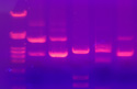 gel electrophoresis