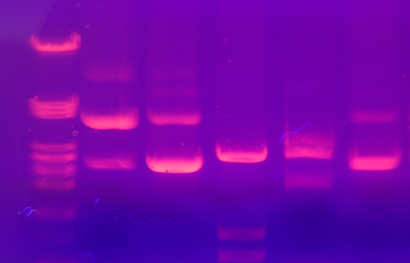 gel electrophoresis