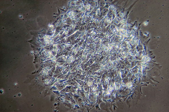 human embryonic stem cells. Human embryonic stem cell