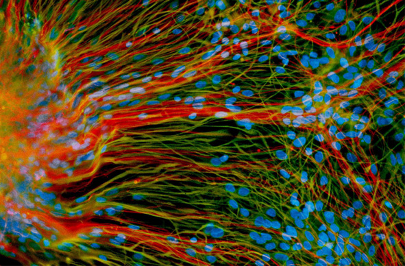 Derived from human embryonic stem cells, precursor neural cells grow in a lab dish and generate mature neurons (red) and glial cells (green), in the lab of University of Wisconsin-Madison stem cell researcher and neurodevelopmental biologist Su-Chun Zhang.