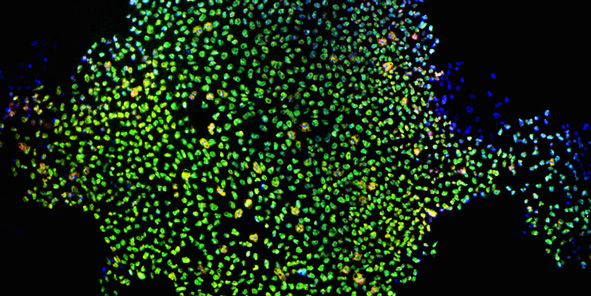 Induced stem cells, adult skin cells that have been genetically reprogrammed to mimic embryonic stem cells